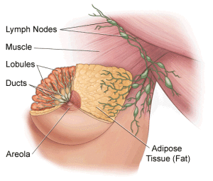 benign-breast-lumps